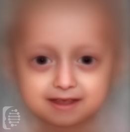 Hutchinson-Gilford Progeria Syndrome