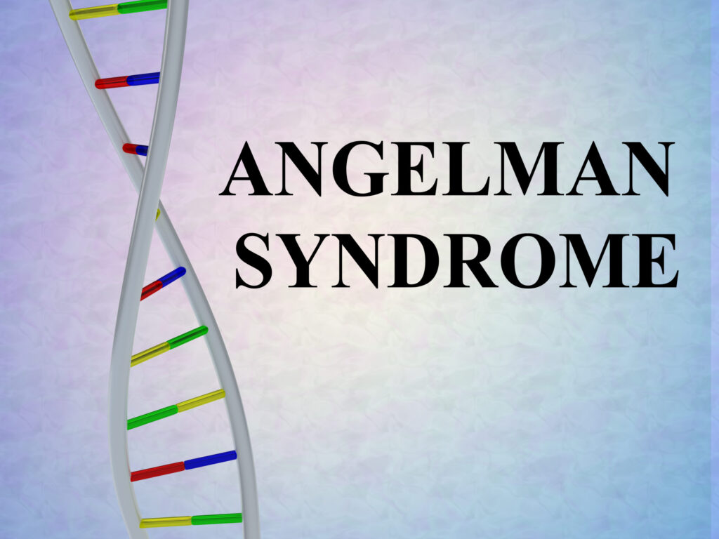 genetic diagnosis angelman syndrome