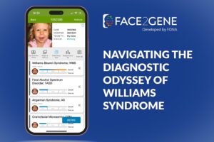 Williams Syndrome